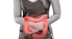 ulcerative colitis