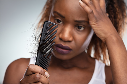 Close-up Of African Shocked Woman Suffering From Hair Loss Problem.
