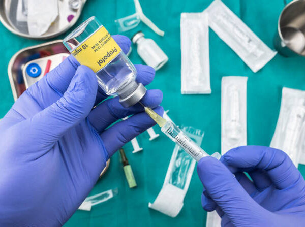 propofol drug