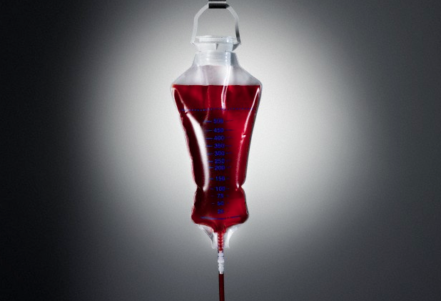 A transfusion bag filled with blood