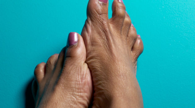 What Causes Feet To Swell