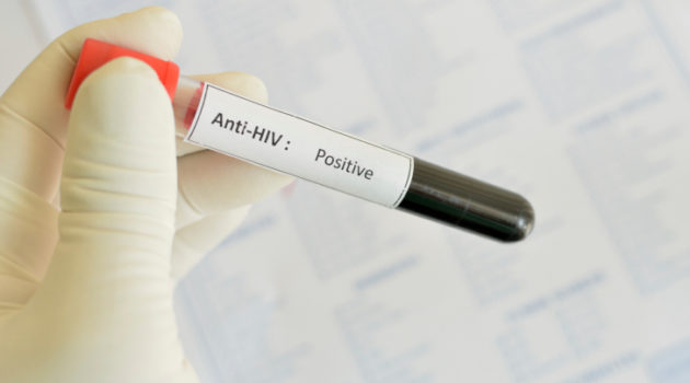blood test that reads positive for HIV