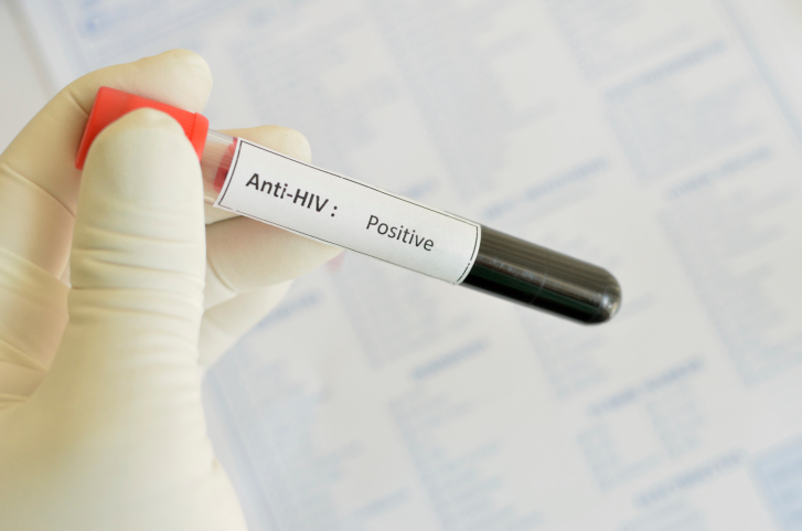 blood test that reads positive for HIV