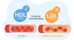 LDL and HDL