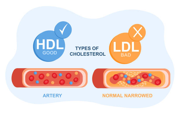 LDL and HDL