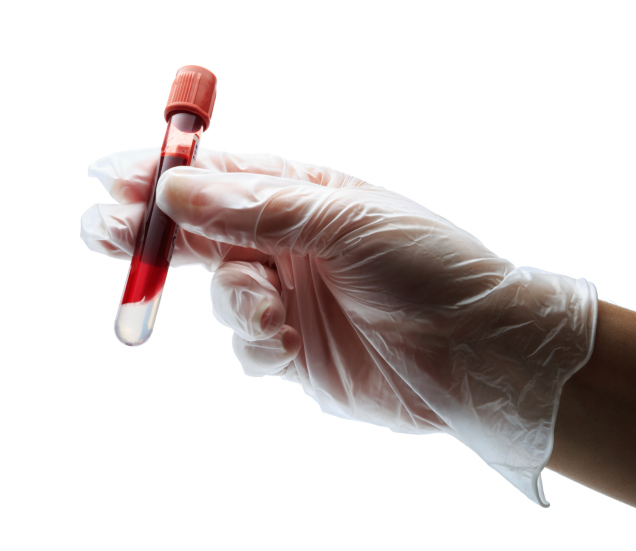 doctor holding blood test