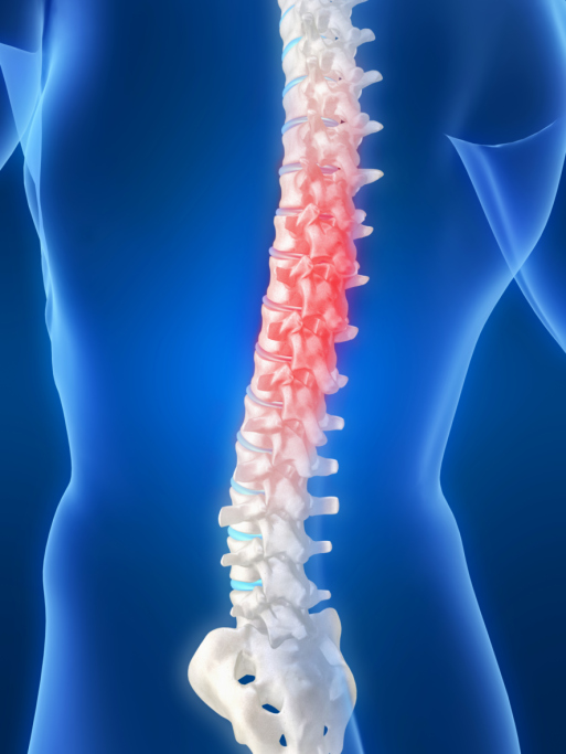 back pain spinal cord