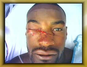tyson car accident
