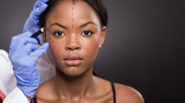 African American woman surgery correction marks on face