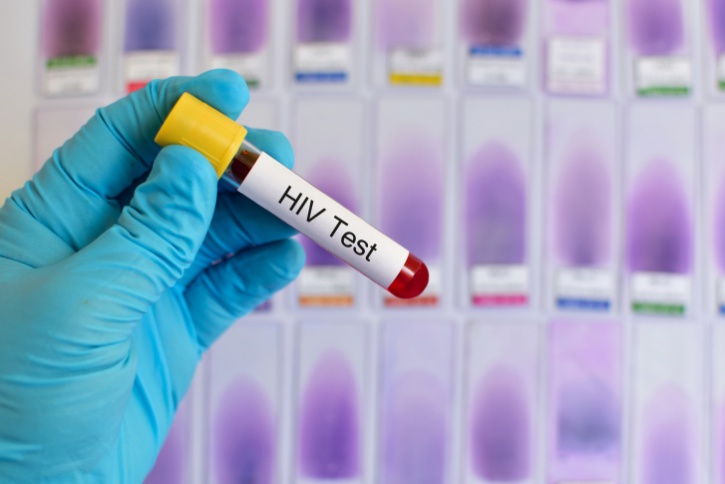 doctor holding hiv test tube