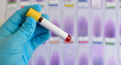blood sample test tube