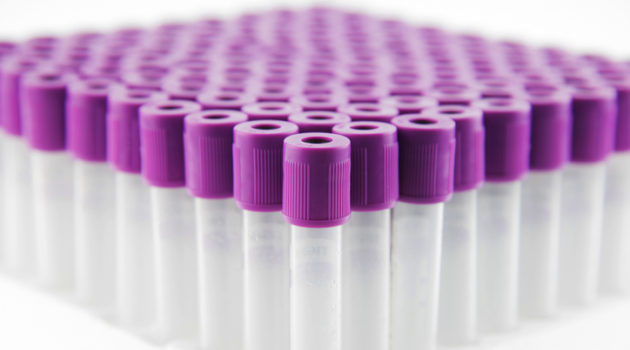 Empty blood sample tubes