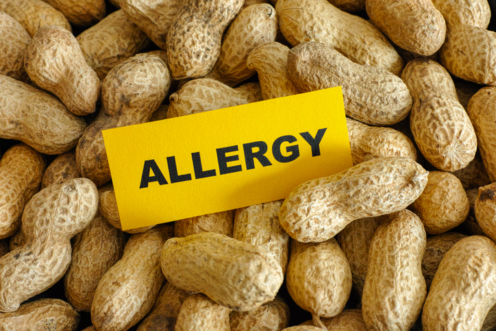peanuts allergy