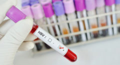 hepatitis B blood sample