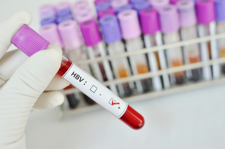 hepatitis B blood sample