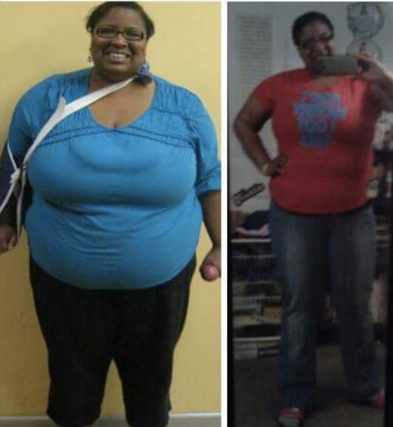 Oprah's Health Hero Loses 150 Pounds: Myra Anderson - BlackDoctor.org ...