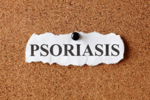 working with psoriasis
