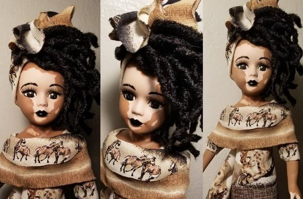 Kay Customs vitiligo dolls