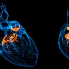 Leaky heart valve can be replaced WITHOUT opening the chest. Find out more about the JOURNEY trial here