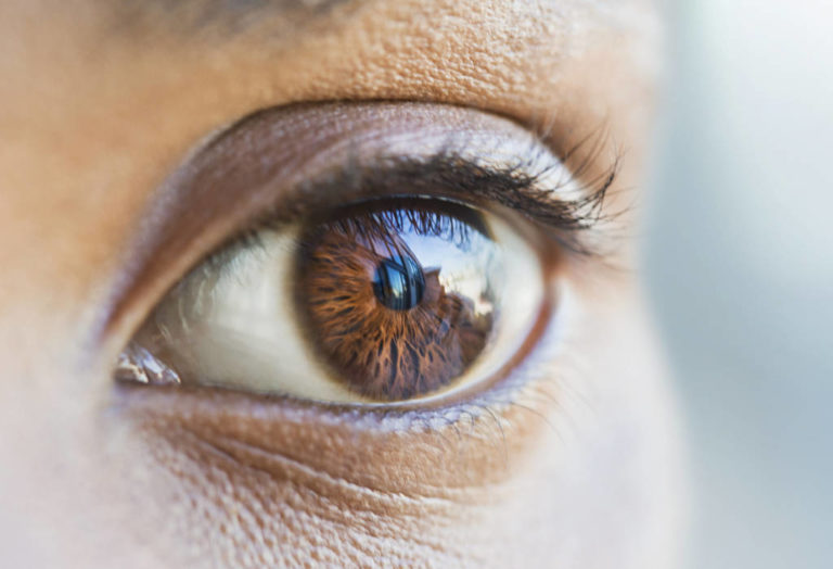 What Is Glassy Eyes Disease? Causes and Prevention - BlackDoctor.org ...