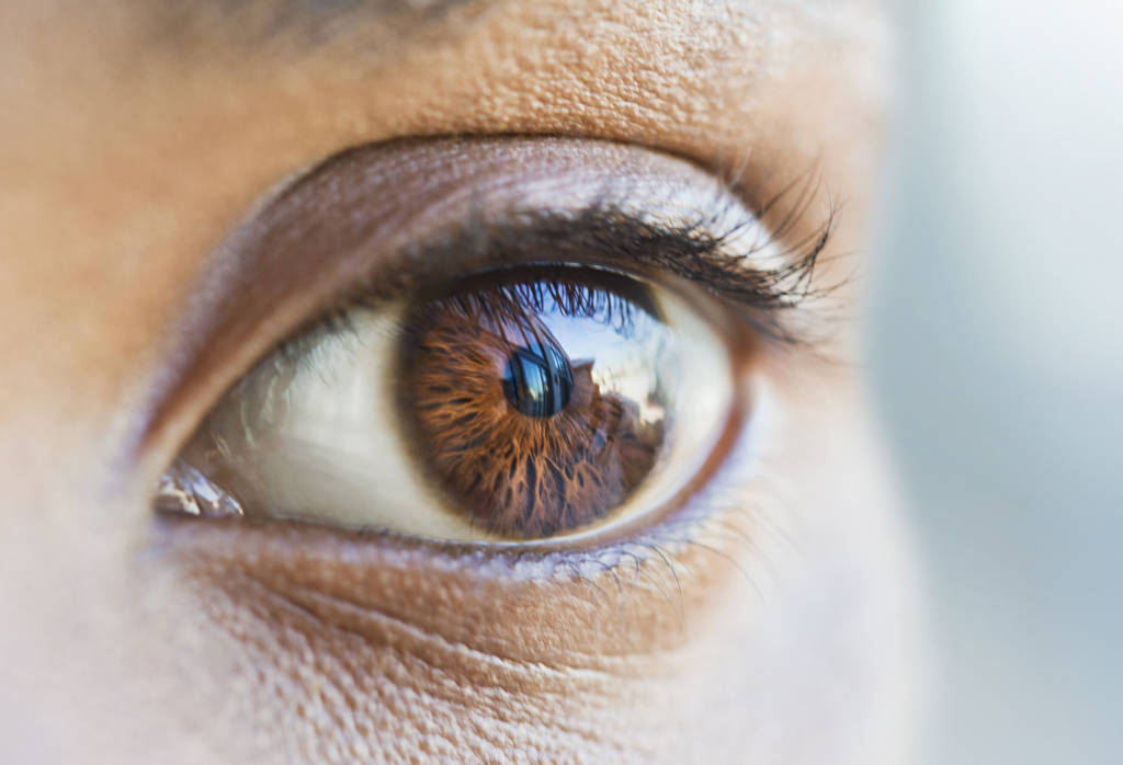 He got brown eyes. Glassy Eyes. Prominent Eyes. Book over Eye photo.