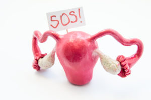 Natural anatomical 3D uterus with ovaries model with placard inscripted SOS referring to patient or doctor for help. Conceived for all symptoms, syndromes, diseases and pathologies of female organs.