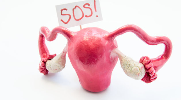 Natural anatomical 3D uterus with ovaries model with placard inscripted SOS referring to patient or doctor for help. Conceived for all symptoms, syndromes, diseases and pathologies of female organs.