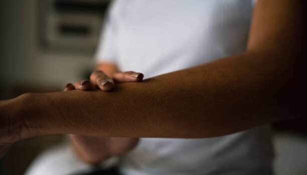 what is psoriasis