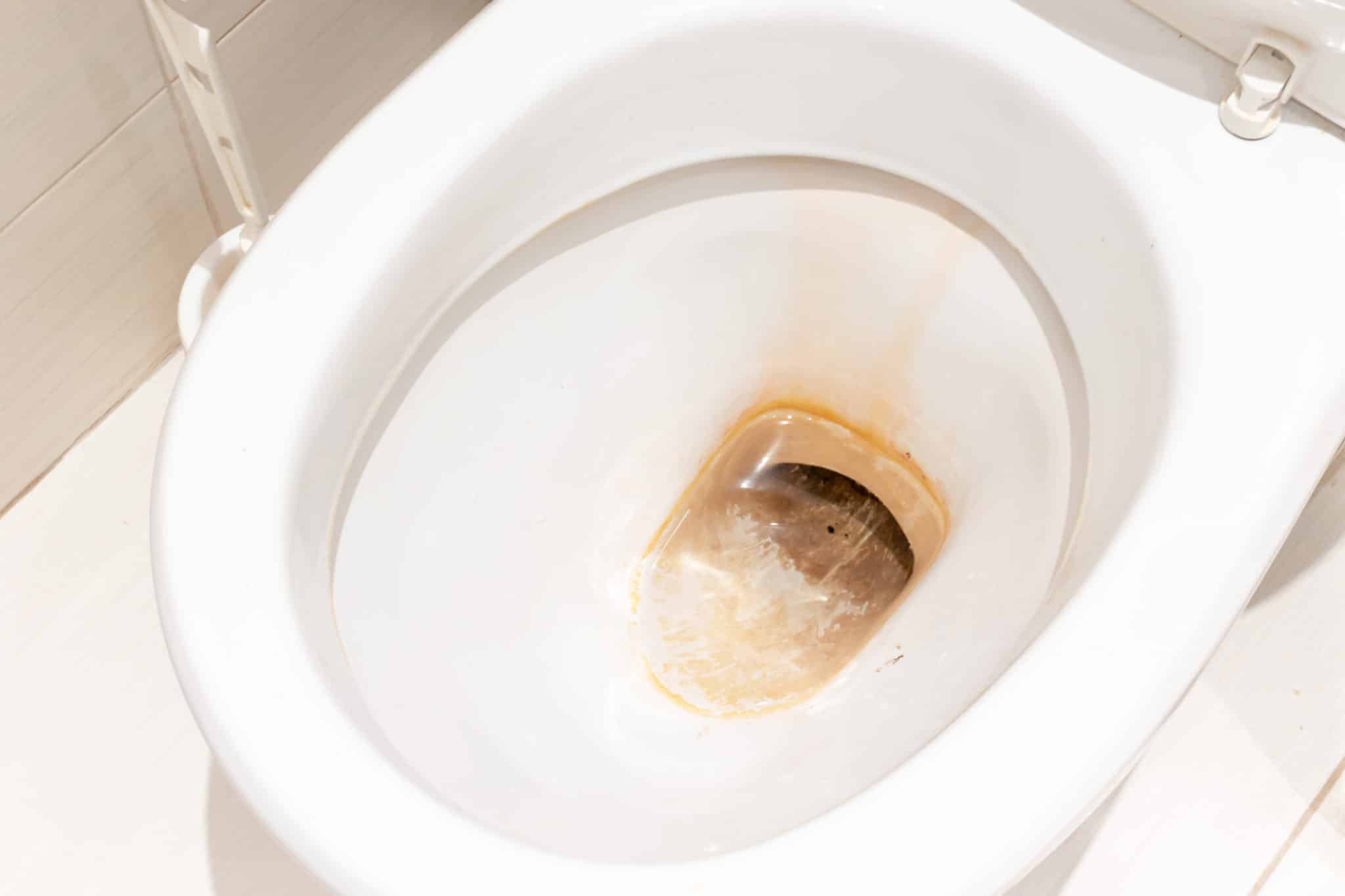 Flushing the Toilet Might Spread Coronavirus Where