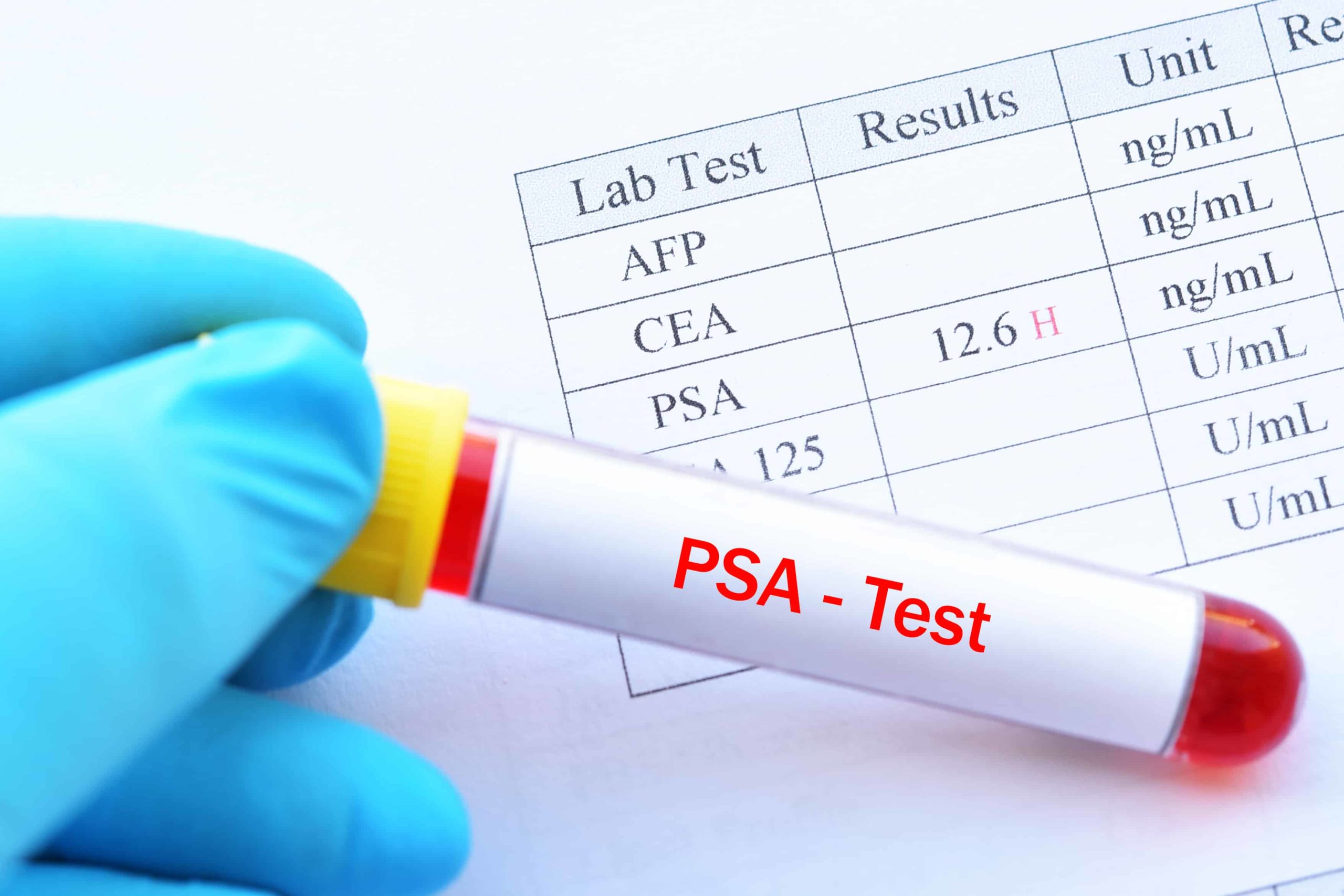 Would prostate cancer show up in a blood test