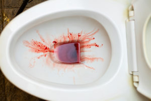 Blood in My Urine