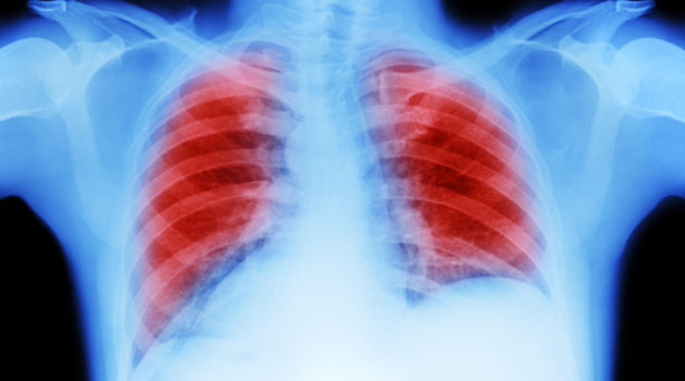 how to get rid of mucus in lungs fast