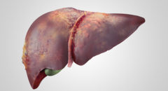 Iillustration of sick human liver with cancer isolated