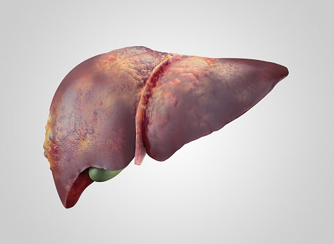 Iillustration of sick human liver with cancer isolated