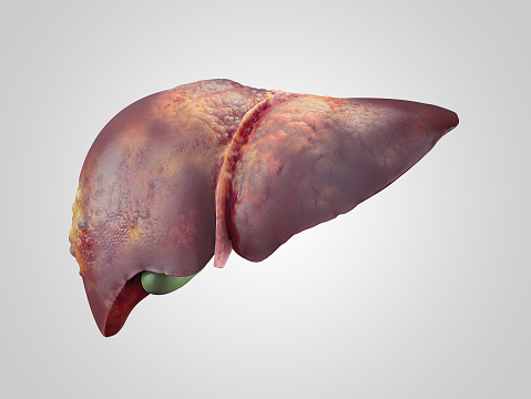 Iillustration of sick human liver with cancer isolated