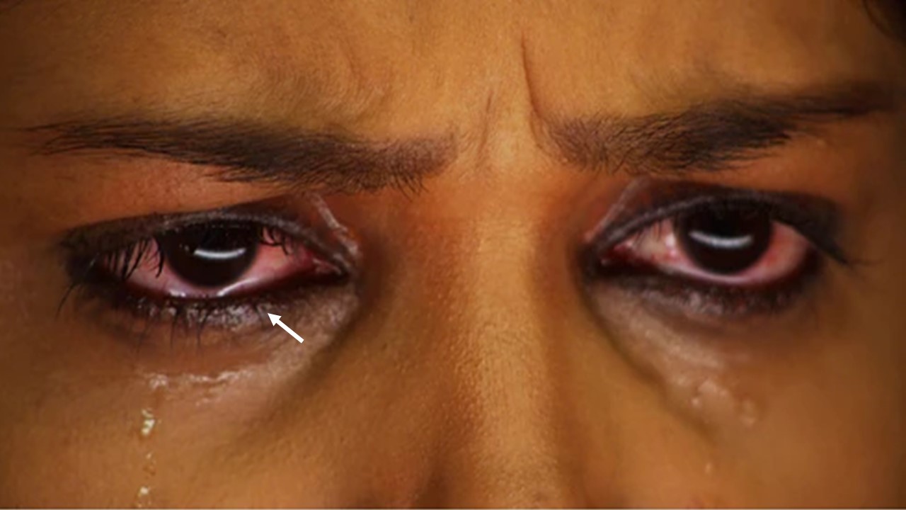 does-crying-make-your-eyelashes-longer-blackdoctor