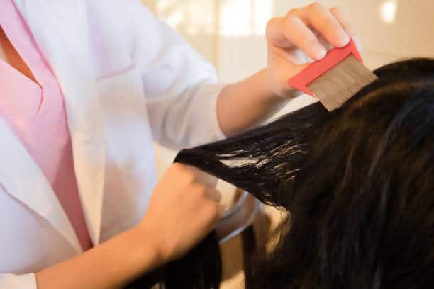 can black people get lice
