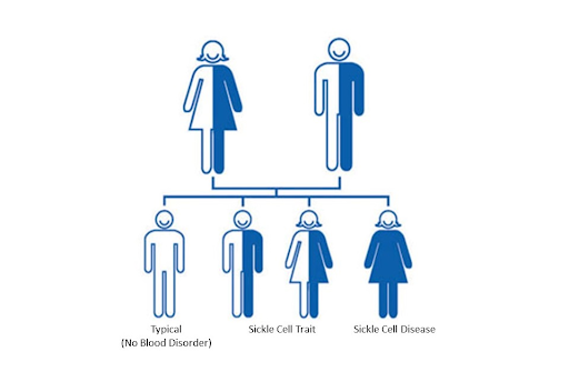 Is Sickle Cell Anemia Dominant Or Recessive 3445