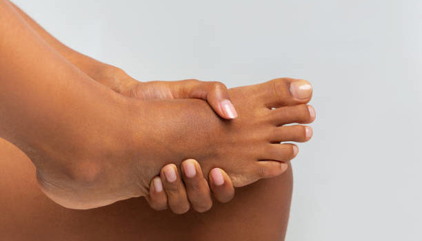 foot psoriasis