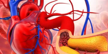 10 Signs You’re Living With Clogged Arteries