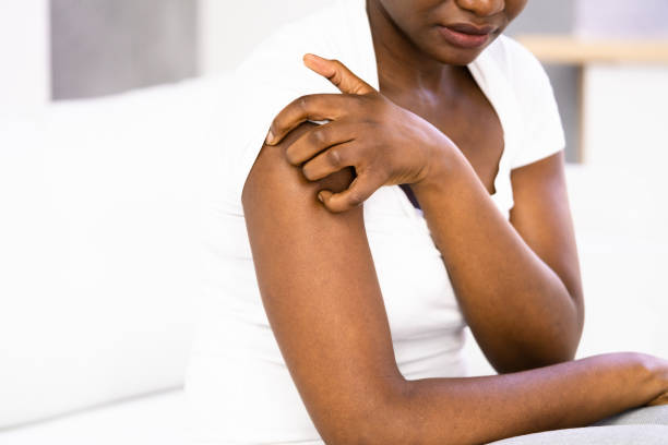 stress-rash-what-is-it-and-how-to-treat-it-blackdoctor