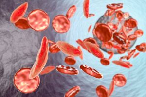 gene therapy