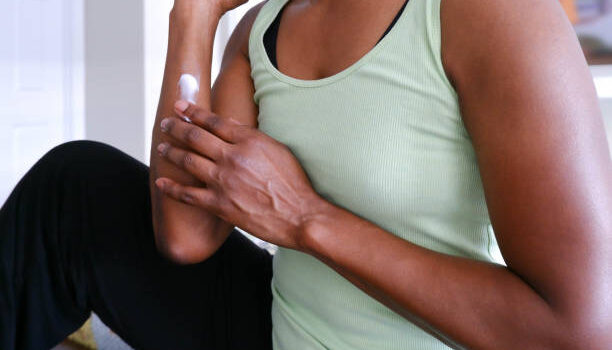 eczema