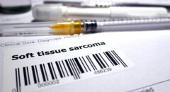 This Sarcoma Clinical Trial Reduces Risk of Relapse by 43%