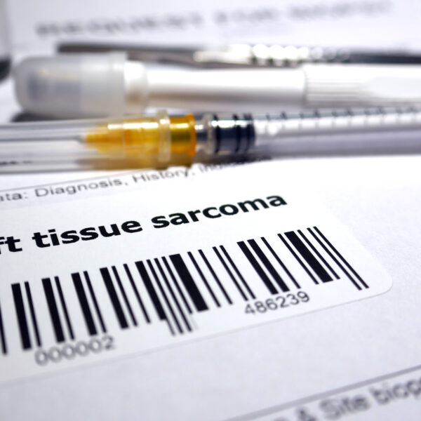 This Sarcoma Clinical Trial Reduces Risk of Relapse by 43%