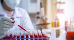 Sickle Cell Gene Therapy Clinical Trials: What Black People Should Know