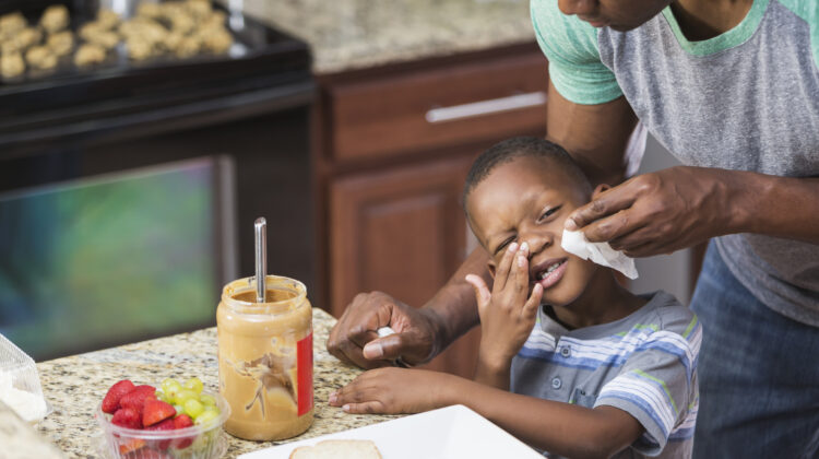 Black Participation in Food Allergy Trials Can Be Life-Saving