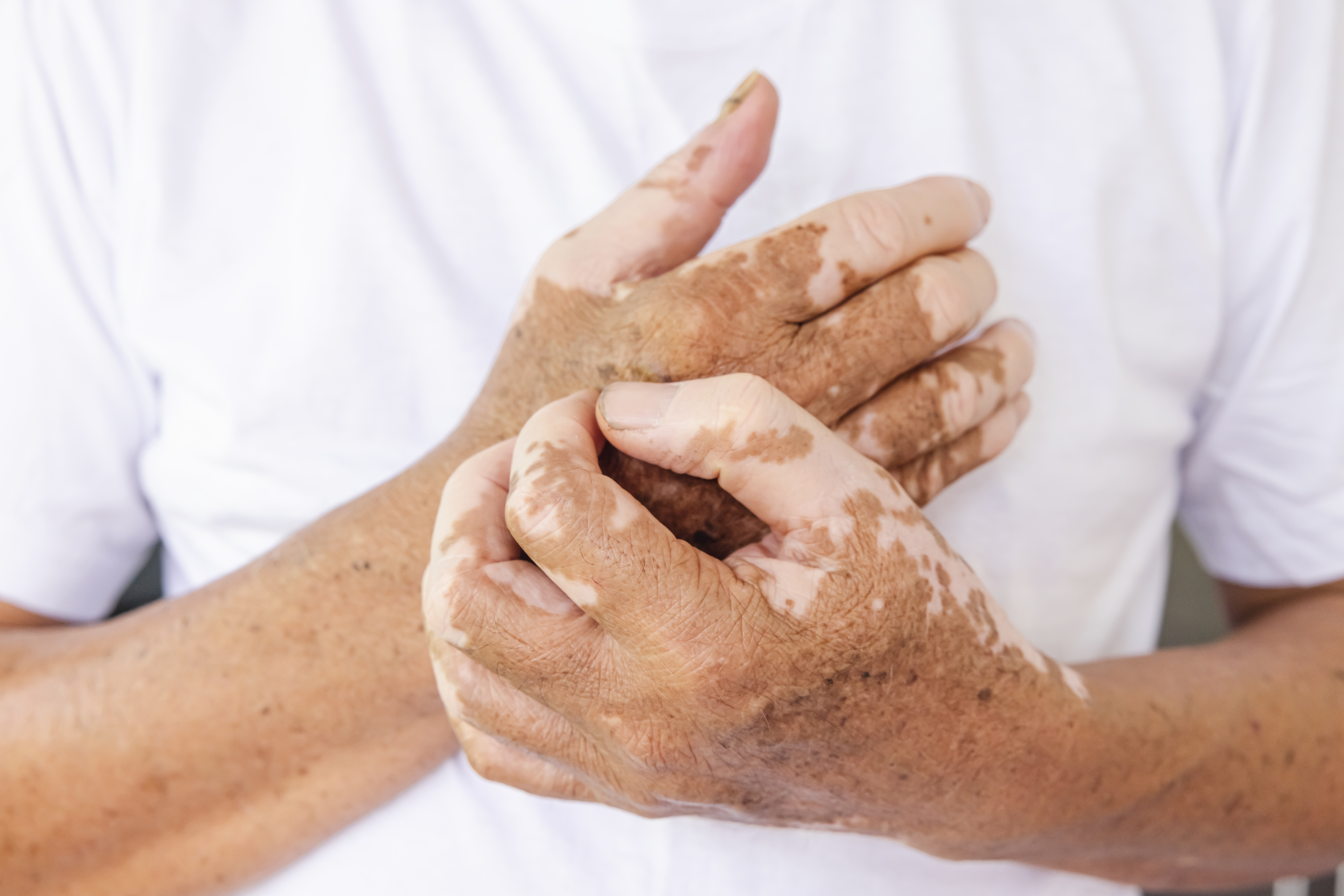 This Is What Black Lupus Patients Think About Clinical Trials