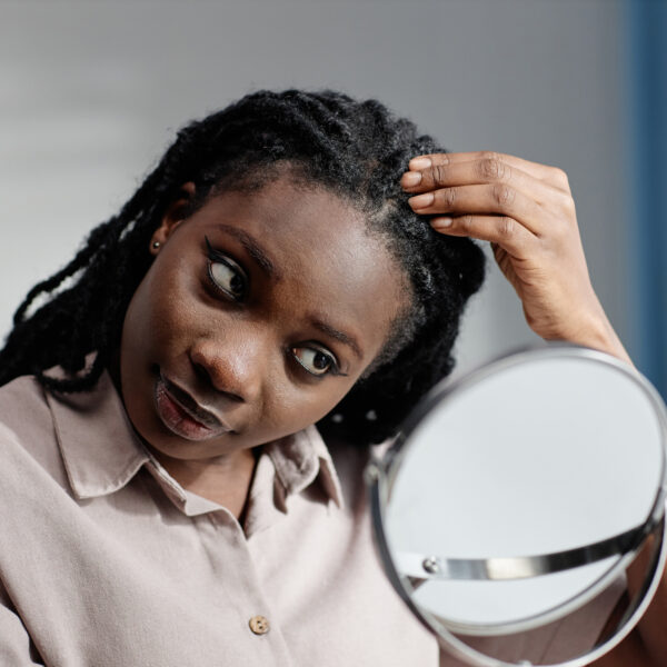 6 Foods that Cause Dandruff
