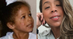 Ashely Lora Did An Eczema Clinical Trial and Found Healing and Purpose